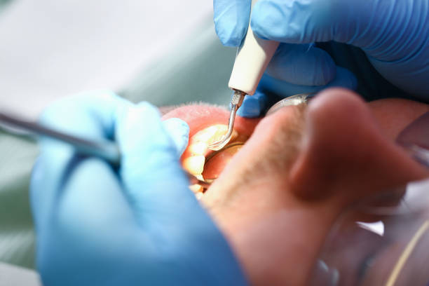 Best Dentist for Dental Trauma  in Lawrence, KS