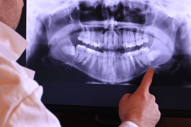 Emergency Dental Filling Replacement in KS